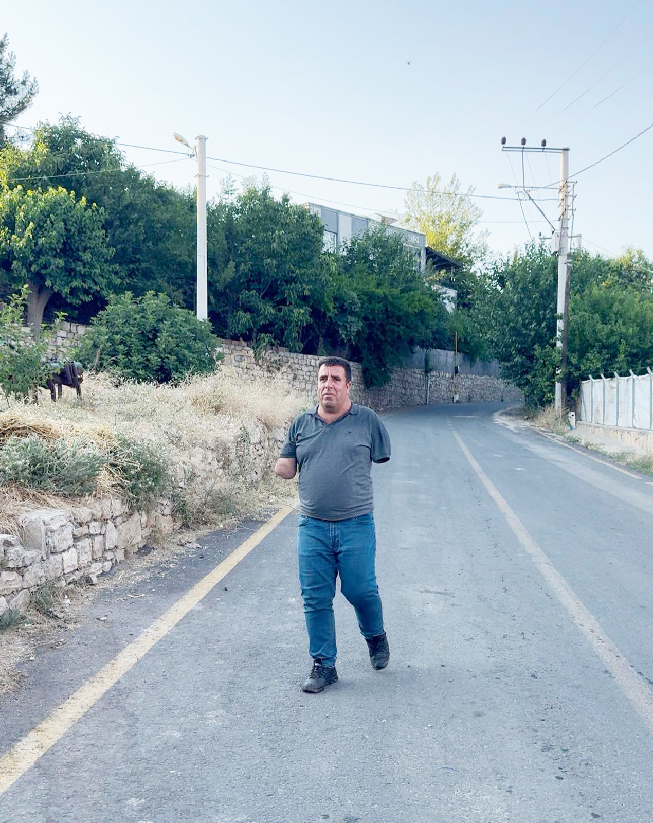 Tek umudu protez kol…